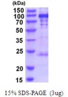 SDS-Page: PYGL Recombinant Protein [NBP2-52066] - 15% SDS Page (3 ug)