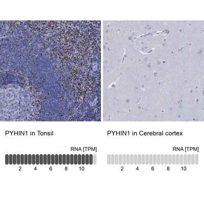 Immunocytochemistry/Immunofluorescence: PYHIN1 Antibody [NBP3-17111] - Analysis in human tonsil and cerebral cortex tissues using Anti-PYHIN1 antibody. Corresponding PYHIN1 RNA-seq data are presented for the same tissues.