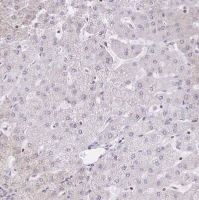 Immunohistochemistry-Paraffin PYHIN1 Antibody