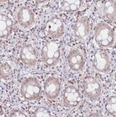 Immunohistochemistry-Paraffin PYHIN1 Antibody