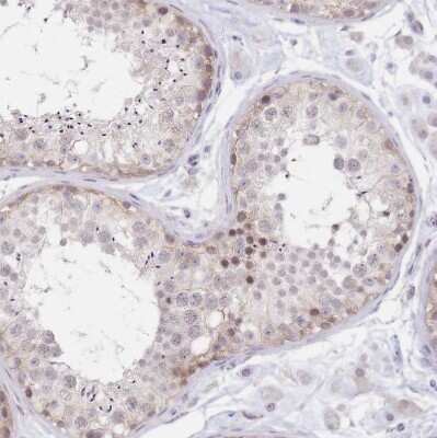 Immunohistochemistry-Paraffin PYHIN1 Antibody