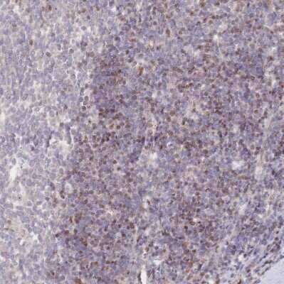 Immunohistochemistry-Paraffin: PYHIN1 Antibody [NBP2-13835] - Staining of human tonsil shows moderate nuclear positivity in non-germinal center cells.