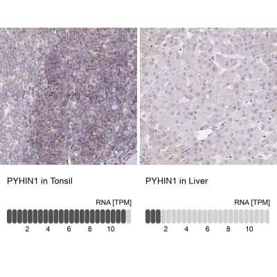 Immunohistochemistry-Paraffin: PYHIN1 Antibody [NBP2-13835] - Staining in human tonsil and liver tissues using NBP2-13835 antibody. Corresponding PYHIN1 RNA-seq data are presented for the same tissues.