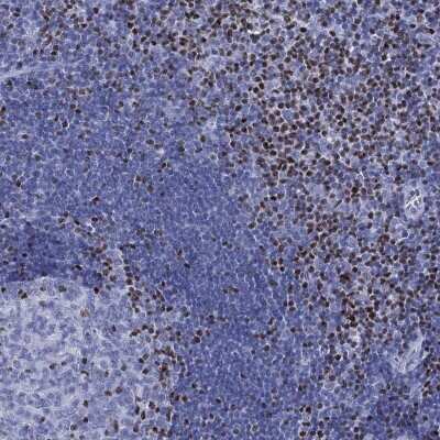 Immunohistochemistry-Paraffin: PYHIN1 Antibody [NBP3-17111] - Staining of human tonsil shows high expression.