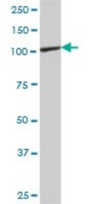 Western Blot: PYK2/FAK2 Antibody [H00002185-B01P] - Analysis of PTK2B expression in rat brain.