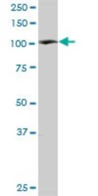 Western Blot: PYK2/FAK2 Antibody [H00002185-D01P] - Analysis of PTK2B expression in rat brain.