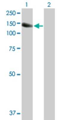 Western Blot: PYK2/FAK2 Antibody [H00002185-D01P] - Analysis of PTK2B expression in transfected 293T cell line by PTK2B polyclonal antibody.Lane 1: PTK2B transfected lysate(115.90 KDa).Lane 2: Non-transfected lysate.