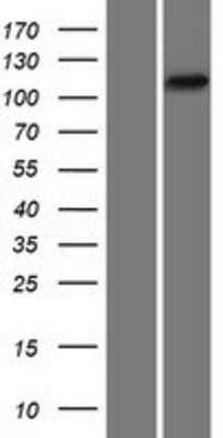 Western Blot: PYK2 Overexpression Lysate (Adult Normal) [NBP2-05141] Left-Empty vector transfected control cell lysate (HEK293 cell lysate); Right -Over-expression Lysate for PYK2.