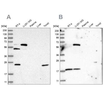 Western Blot: PYROXD2 Antibody [NBP1-88531] - Analysis using Anti-PYROXD2 antibody NBP1-88531 (A) shows similar pattern to independent antibody NBP2-32688 (B).