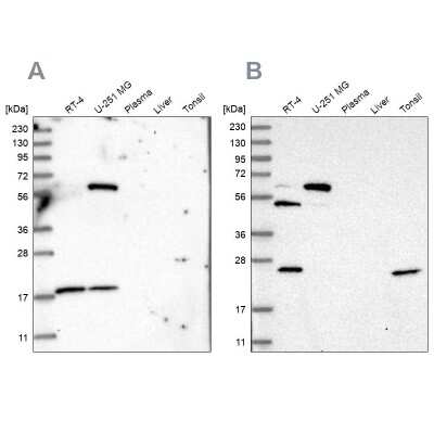 Western Blot: PYROXD2 Antibody [NBP2-32688] - Analysis using Anti-PYROXD2 antibody NBP2-32688 (A) shows similar pattern to independent antibody NBP1-88531 (B).