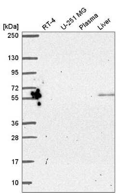 Western Blot: PYROXD2 Antibody [NBP2-57244] - Western blot analysis in human cell line RT-4, human cell line U-251 MG, human plasma and human liver tissue.