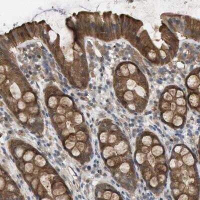 Immunohistochemistry-Paraffin Paladin Antibody