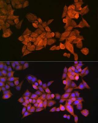 Immunocytochemistry/Immunofluorescence: Palladin Antibody [NBP2-93983] - Analysis of HeLa cells using Palladin . Blue: DAPI for nuclear staining.