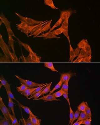 Immunocytochemistry/Immunofluorescence: Palladin Antibody [NBP2-93983] - Analysis of NIH-3T3 cells using Palladin . Blue: DAPI for nuclear staining.