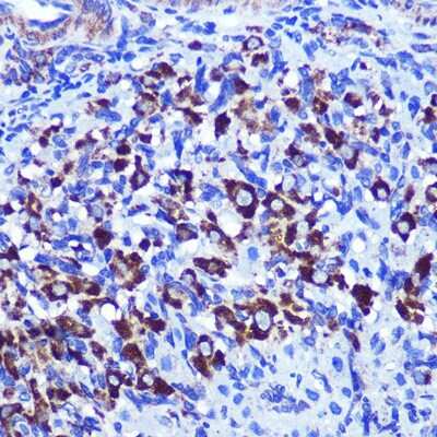 Immunohistochemistry-Paraffin: Palladin Antibody [NBP2-93983] - Paraffin-embedded rat ovary using Palladin .
