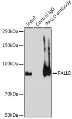 Immunoprecipitation: Palladin Antibody [NBP2-93983] - Immunoprecipitation analysis of 200ug extracts of A-549 cells using 3ug Palladin antibody (NBP2-93983). Western blot was performed from the immunoprecipitate using Palladin antibody (NBP2-93983) at a dilution of 1:1000.