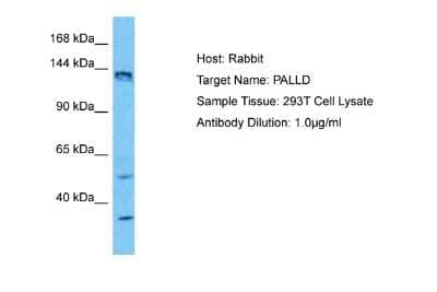 Western Blot: Palladin Antibody [NBP2-88004] - Host: Rabbit. Target Name: PALLD. Sample Type: 293T Whole Cell lysates. Antibody Dilution: 1.0ug/ml
