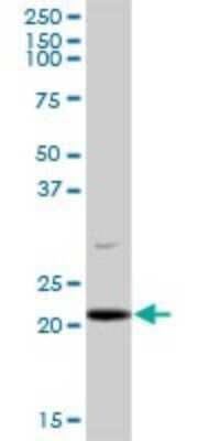 Western Blot: Pallidin Antibody [H00026258-B01P] - Analysis of PLDN expression in human spleen.