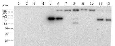 Unknown Pan Coronavirus Spike Antibody (39) - Azide and BSA Free