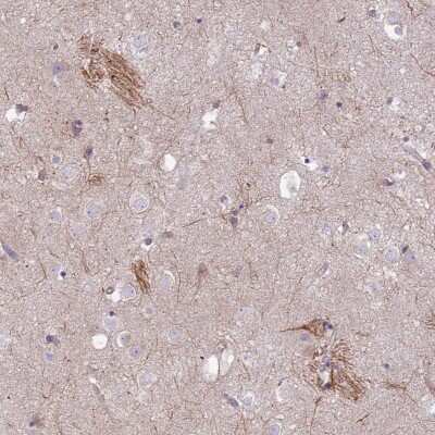 Immunohistochemistry-Paraffin: Pan KvBeta Antibody [NBP1-90194] - Staining of human lateral ventricle shows cytoplasmic positivity in a subset of glial cells.