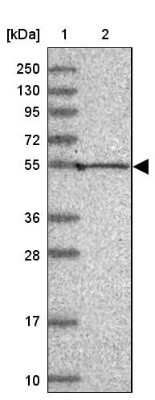 Western Blot: Pan KvBeta Antibody [NBP1-90194] - Lane 1: Marker  [kDa] 250, 130, 95, 72, 55, 36, 28, 17, 10.  Lane 2: Human cell line RT-4