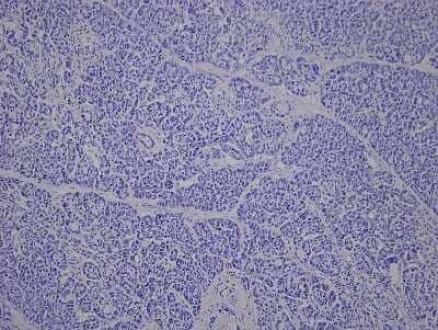 Hematoxylin & Eosin Stain: Pancreas Tissue Slides (Diabetes) [NBP2-78038] - Tissue: Human Pancreas,  Pathology: Diabetes