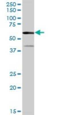 Western Blot: Pancreatic Amylase Alpha Antibody [H00000279-B01P] - Analysis of AMY2A expression in human pancreas.