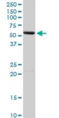 Western Blot: Pancreatic Amylase Alpha Antibody [H00000279-D01P] - Analysis of AMY2A expression in human pancreas.