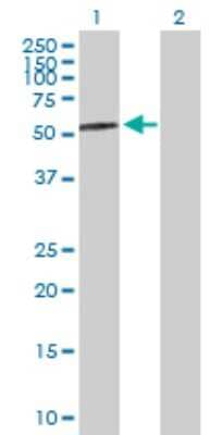 Western Blot: Pancreatic Amylase Alpha Antibody [H00000279-D01P] - Analysis of AMY2A expression in transfected 293T cell line by AMY2A polyclonal antibody.Lane 1: AMY2A transfected lysate(57.70 KDa).Lane 2: Non-transfected lysate.