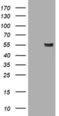 Western Blot: Pancreatic Amylase Beta Antibody (OTI4B5) - Azide and BSA Free [NBP2-73240] - Analysis of HEK293T cells were transfected with the pCMV6-ENTRY control (Left lane) or pCMV6-ENTRY Amylase beta.