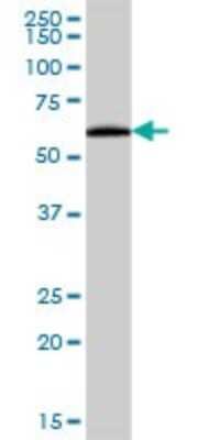 Western Blot: Pancreatic Amylase Beta Antibody [H00000280-B01P] - Analysis of AMY2B expression in human pancreas.