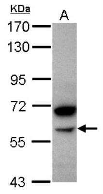 Western Blot: Pancreatic Amylase Beta Antibody [NBP2-19687] - Pancreatic Amylase Beta Antibody Sample (30 ug of whole cell lysate) A: Jurkat 7. 5% SDS PAGE gel, diluted at 1:1000.