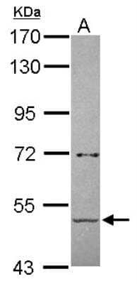 Western Blot: Pancreatic Amylase Beta Antibody [NBP2-19688] - Pancreatic Amylase Beta Antibody Sample (30 ug of whole cell lysate) A: A431 7. 5% SDS PAGE gel, diluted at 1:500.