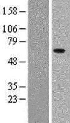 Western Blot: Pancreatic Amylase Beta Overexpression Lysate (Native) [NBL1-07510] - Left-Empty vector transfected control cell lysate (HEK293 cell lysate); Right -Pancreatic Amylase Beta Overexpression Lysate (Native).