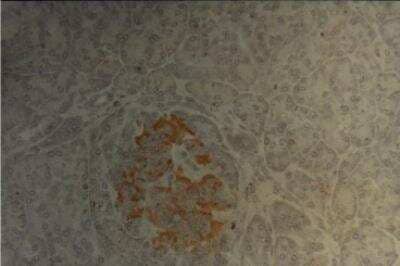 Immunohistochemistry: Pancreatic Islet Lysate Antibody (LIV3D3) [NBP2-50233]