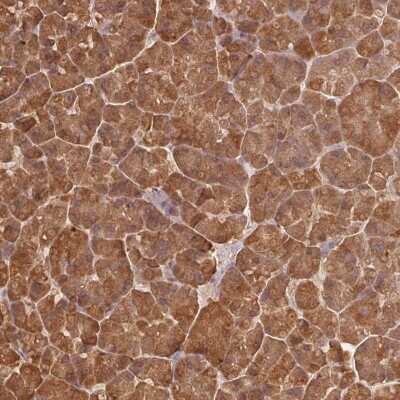 Immunohistochemistry-Paraffin: Pancreatic Lipase Antibody [NBP2-38962] - Staining of human pancreas shows high expression.