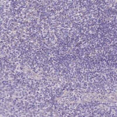 Immunohistochemistry-Paraffin: Pancreatic Lipase Antibody [NBP2-38962] - Staining of human tonsil shows low expression as expected.