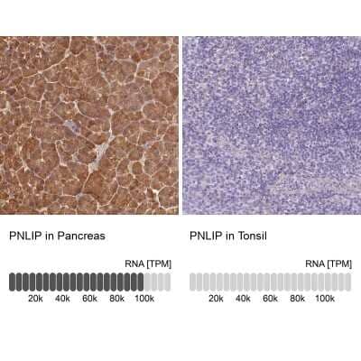 <b>Orthogonal Strategies Validation. </b>Immunohistochemistry-Paraffin: Pancreatic Lipase Antibody [NBP2-38962] - Staining in human pancreas and tonsil tissues using anti-PNLIP antibody. Corresponding PNLIP RNA-seq data are presented for the same tissues.