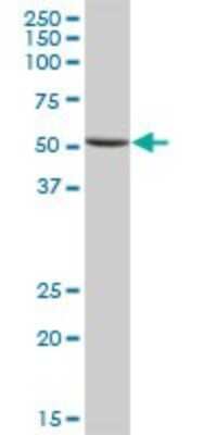 Western Blot: Pancreatic Lipase Antibody [H00005406-B01P] - Analysis of PNLIP expression in human pancreas.