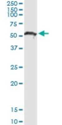 Western Blot: Pancreatic Lipase Antibody [H00005406-D01P] - Analysis of PNLIP expression in human pancreas.