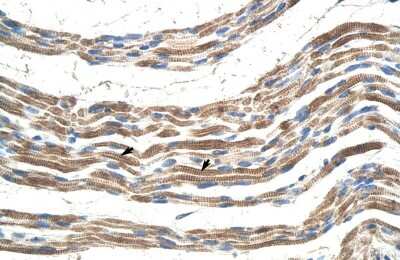 Immunohistochemistry-Paraffin: Pannexin-2 Antibody [NBP1-59671] - Human Muscle Tissue, Skeletal muscle cells (Indicated with Arrows) 4-8ug/ml.