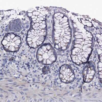 Immunohistochemistry-Paraffin: Pannexin-2 Antibody [NBP1-92242] - Staining of human rectum shows low expression as expected.