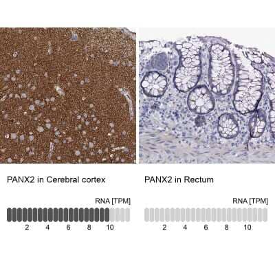 <b>Orthogonal Strategies Validation. </b>Immunohistochemistry-Paraffin: Pannexin-2 Antibody [NBP1-92242] - Staining in human cerebral cortex and rectum tissues using anti-PANX2 antibody. Corresponding PANX2 RNA-seq data are presented for the same tissues.