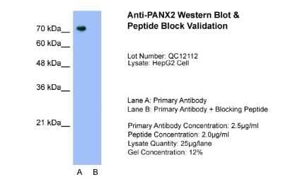 Western Blot: Pannexin-2 Antibody [NBP1-59671] - Sample Tissue: HepG2, Lane A: Primary Antibody, Lane B: Primary Antibody + Blocking Peptide, Primary Antibody Concentration: 2.5ug/mL, Peptide Concentration: 2.0ug/mL, Lysate Quantity: 25ug/lane, Gel Concentration: 12%