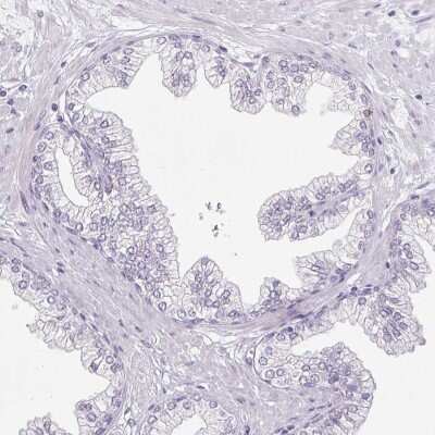 Immunohistochemistry-Paraffin: Pappalysin-2/PAPP-A2 Antibody [NBP1-87339] - Staining of human prostate shows low expression as expected.