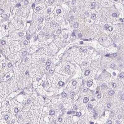 Immunohistochemistry-Paraffin: Pappalysin-2/PAPP-A2 Antibody [NBP1-87339] - Staining of human liver.