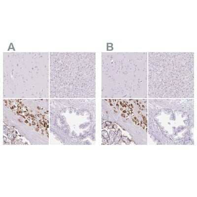 <b>Independent Antibodies Validation and Orthogonal Strategies Validation.</b>Immunohistochemistry-Paraffin: Pappalysin-2/PAPP-A2 Antibody [NBP1-87339] - Staining of human cerebral cortex, liver, placenta and prostate using Anti-PAPPA2 antibody NBP1-87339 (A) shows similar protein distribution across tissues to independent antibody NBP1-87340 (B).