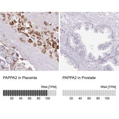 Immunohistochemistry-Paraffin: Pappalysin-2/PAPP-A2 Antibody [NBP1-87339] - Analysis in human placenta and prostate tissues using NBP1-87339 antibody. Corresponding PAPPA2 RNA-seq data are presented for the same tissues.