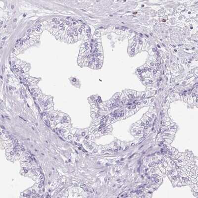 Immunohistochemistry-Paraffin: Pappalysin-2/PAPP-A2 Antibody [NBP1-87340] - Staining of human prostate shows low expression as expected.