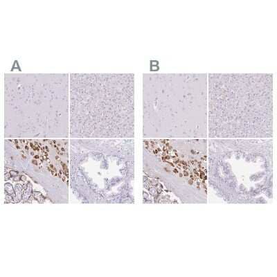 <b>Independent Antibodies Validation and Orthogonal Strategies Validation.</b>Immunohistochemistry-Paraffin: Pappalysin-2/PAPP-A2 Antibody [NBP1-87340] - Staining of human cerebral cortex, liver, placenta and prostate using Anti-PAPPA2 antibody NBP1-87340 (A) shows similar protein distribution across tissues to independent antibody NBP1-87339 (B).